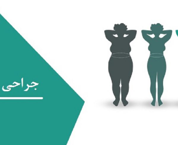 جراحی چاقی نوعی جراحی زیبایی برای افرادی که کاهش وزن شدید داشته اند