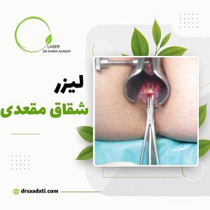 لیزر شقاق مقعدی(فیشر)؛انواع روش ها،مراحل و مزایای لیزر فیشر