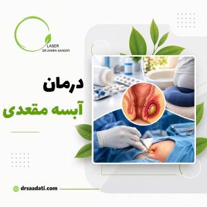درمان آبسه مقعدی ؛ روش های خانگی،دارویی،جراحی و لیزر