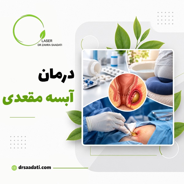 درمان آبسه مقعدی ؛ روش های خانگی،دارویی،جراحی و لیزر